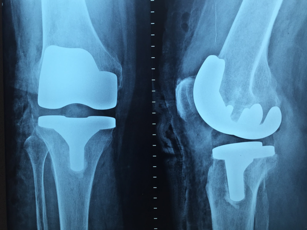 Types of Orthopaedic Surgery